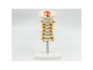Coloana cervicala cu artera vertebrala (cod S18)